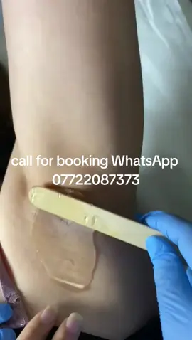 #LaserHairRemoval  #foryoupage #skincare  #beauty  #london 