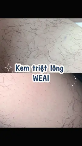 Kem triệt lông WEAI, đến từ thương hiệu NHẬT BẢN, dễ sử dụng không gây đau rát #NovoDoveCabelos 