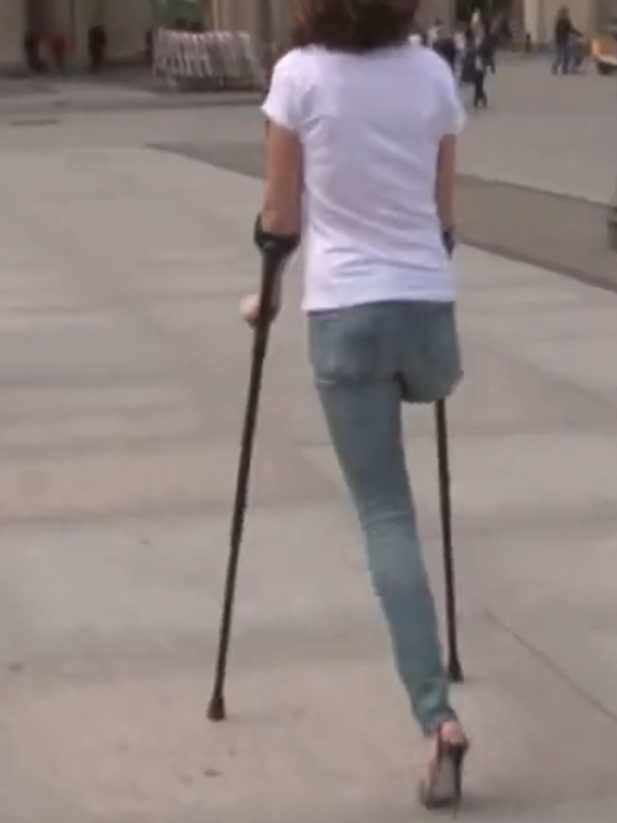 Esta preciosa mujer perdio una pierna pero aunque solo tenga una pierna lleva una vida normal como la de cualquier persona. Gran ejemplo de superación 🙌🏼 #amputee #oneleg #disabled #disability #discapacidad 