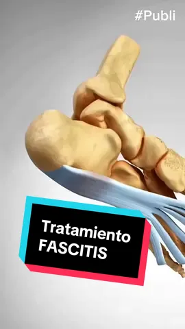 ¿Dolor de pies? ¿Fascitis Plantar? ¡Te traigo la solución! 👣 Podoks es un calcetín diseñado por podólogos que imita un vendaje funcional, estabilizando el pie y amortiguando cada impacto gracias a sus piezas en la planta, para que puedas moverte con menos dolor y tener ese apoyo extra que necesitan tus pies ⚙️🦶🏻. Un producto que recomiendo al 100%. 🚀 Y este Black Friday los puedes conseguir con un 20% de descuento en modelos seleccionados 💪🏻👣 En www.podoks.com #fascitis #espolon #podoks #podologia #fascitisplantar 