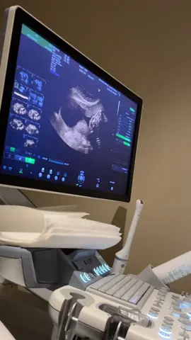 ‏الحمدلله الذي أكرمني ورزقني شعور الأمومة ماشاءالله تبارك الرحمن #امومة #حمل_وولادة #سونار #بنتي #تجهيزات_مواليد 
