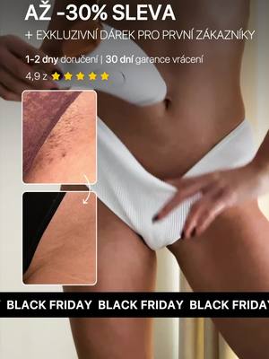 Už žádné chloupky, navždy!