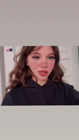 🌑🎀 #foryoupage #fyyyyyyyyyyyyyyyy 