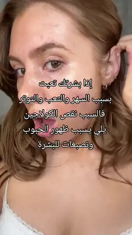 قد ماحكين عن الكولاجين البحري وعن جمالو وفعاليتو مابخلص 😍#اعملولي_اعادة_نشر😒 #لايك__explore___ #متابعه_ولايك_واكسبلور_احبكم 