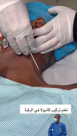 #تركيب_كانيولا #تدريب #ممرض #شعب_الصيني_ماله_حل😂😂 #اكسبلورexplore 