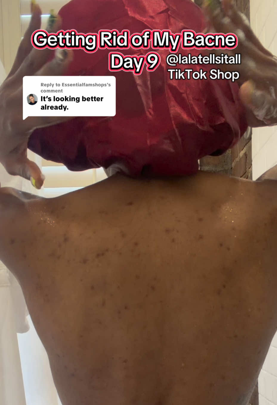 Replying to @Essentialfamshops my back is feeling smoother and better overall. I’m excited to keep going! #Tiktokshopcreatorpicks #tiktokshopcybermonday #superbranddaybfcm #tiktokshopblackfriday #healthandwellnessdeals 