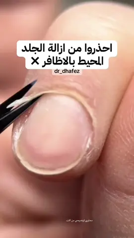 #ظافر_ال_حافظ #ظافر_الحافظ #الاظافر#العنايه_بالاظافر#تجميل