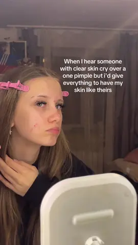 #acne #repost #fyp 