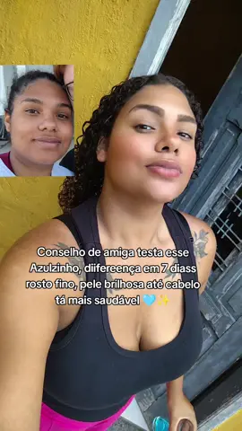 Meu combo predileto com Magnésio, vitamina B6,B12 olha esse brilho✨ #fypシ゚ 