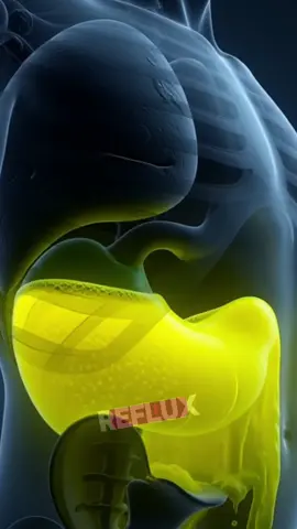 5 foods to reduce acid reflux. #acidreflux #reflux #unitedstates 