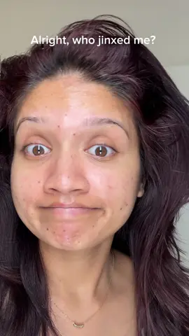 Whoever did nazar… please undo it😭😭🙏   #acneskin #acneproneskin #cysticacne #acnejourney #acnecommunity 