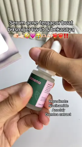 #acneno #acnenoserum #acnenoindonesia #jerawat #acnefighter 