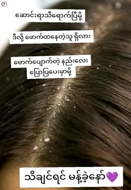 #ဗောက်ပျောက်စေတဲ့အထိရောက်ဆုံးသဘာဝနည်း #09423865371 #CMbrandlocal #ဗောက်ပြဿနာ #စေတနာကောင်းရင်ကံကောင်းမည် @chanmyaecmbrandfounder 