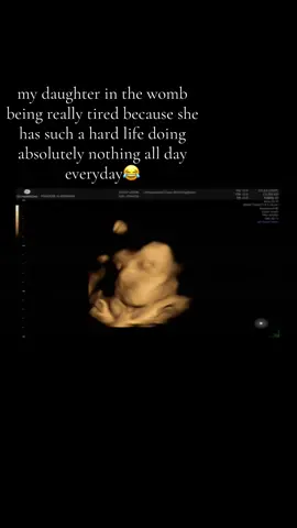 sometimes i wonder how she’s so tired but remember she just flips around all day, eats and drinks everything i do, and uses my bladder as a bouncy castle so no wonder she’s tired 24/7🤦🏼‍♀️#30weekspregnant #4dscan #babygirl #fyp 