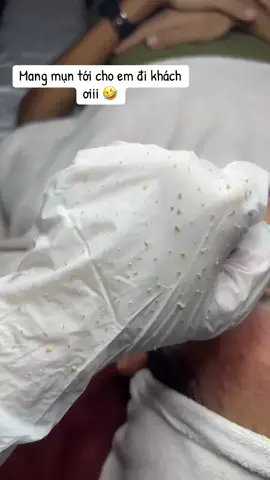 Tết tới nơi rồi … làm sạch mụn thôi mn ơiii #lamdep #spabaria #mụn #xuhuong 