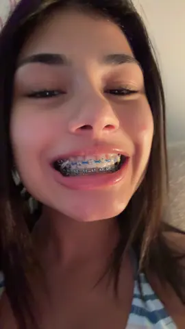 yayyyy braces are off!! #teethtransformation 