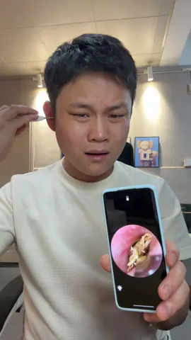 ライト明るい＋高画質。 細かい汚れまで全部見える。 #高画質 #耳掃除動画 #見える安心 #イヤーカメラ