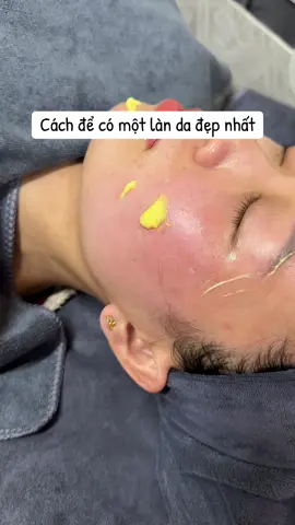 Peel da đón Tết thôi ạ #daotaohocvienchuyennghiep #peelda #dieutrinamtannhang #tannhang_nám #trangsangda 