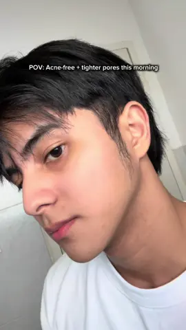 Skin’s been looking better lately. Consistency > everything 😊 #foryou #skinnyjozua #skintific #cleanser #CapCut 