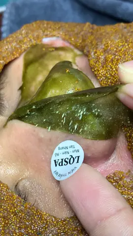 Sướng dữ#chamsocdamun#chamsocdaseo#chamsocdanam#tanbinh#Lqspa&academy