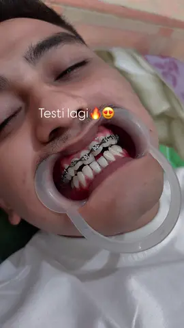 #behellhokseumawe #behelgigi #behelhomeservice #behelkruenggeukeuh #behelbandaaceh 