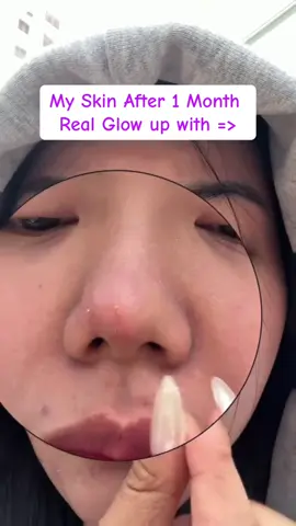 Start using Bakuchiol Retinol Serum 💜  #venaturebakuchiol #bakuchiol #retinol #fyp #serum 