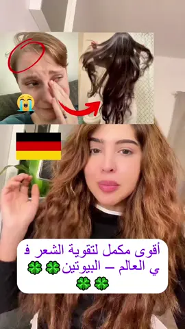 In anderen Ländern ist es bereits ausverkauft, nur in Frankreich und Deutschland ist es noch erhältlich! Es sind nur noch die letzten 100 Bestellungen verfügbar! Es hilft deinem Körper, Vitamine aufzunehmen, macht dein Haar dichter und voller, lässt deine Haut strahlender aussehen, stärkt deine Nägel und unterstützt deine Gesundheit von innen nach außen.🔥لقد نَفَد من معظم الدول، ولم يتبقَّ سوى فرنسا وألمانيا فقط! لم يبقَ إلا آخر 100 طلب!♥️ يساعد على تزويد جسمك بالفيتامينات، ويجعل شعرك أكثر كثافة وامتلاء، ويجعل بشرتك أكثر إشراقًا، ويقوّي أظافرك، ويعتني بصحتك من الداخل إلى الخارج. #نمو_الشعر #TikTokShopBlackFriday #الثقة #تساقط_الشعر #UnboxYourDeadone