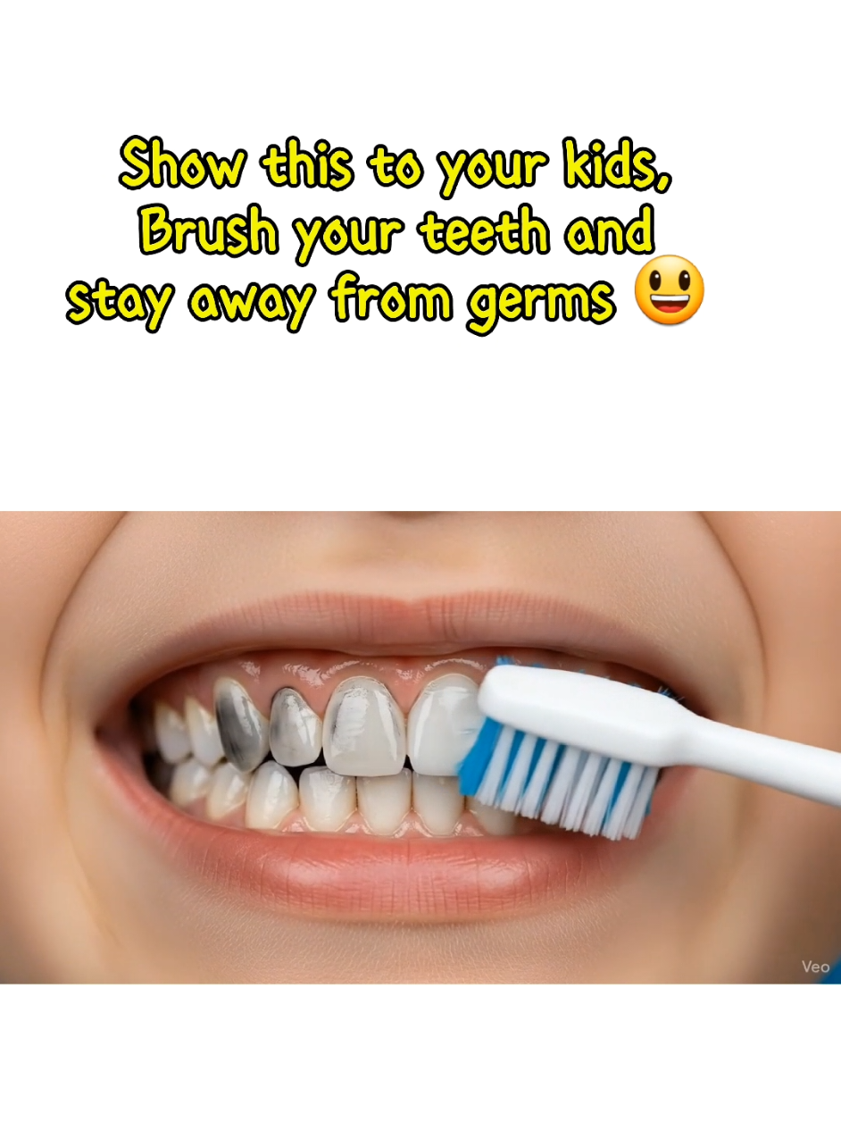 Dear Kids, brush your teeth every day! 🦌✨ Shiny teeth, no germs, happy smiles! Let’s keep those cavities away, kids! 😄🦷 #foryoupage  #HealthyTeeth #BrushEveryDay #ViralKidsContent #creatorsearchinsights 