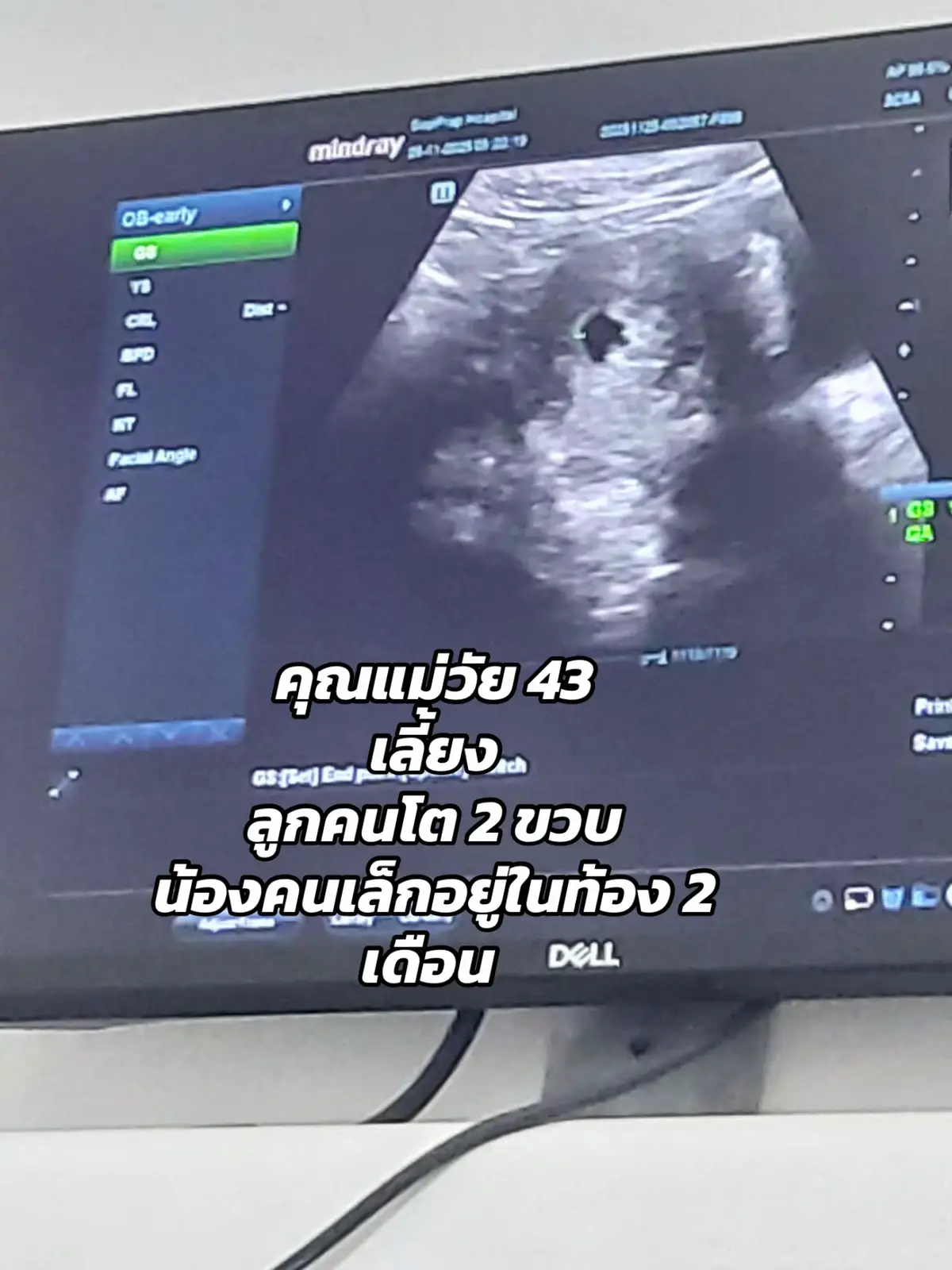 คุณแม่วัย 43 พี่ต้องเลี้ยงลูกเล็กจากนี้เราต้องใช้ชีวิตเพื่อเขาทั้งสองคน ##เมื่อมีเธอแล้ว##หัวใจดวงที่4