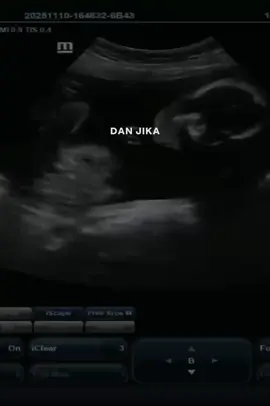 Masyaallah tabarakallah 🥹🥹🫶🏻 sehat ya anakku #CapCut #bumil #23week #hplmaret #bumilhappy 