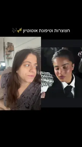 ‏#דואט עם @אלמוג פישמן 🎙️ white kila #חיקוי #אלמוגפישמן #נועהקירל 