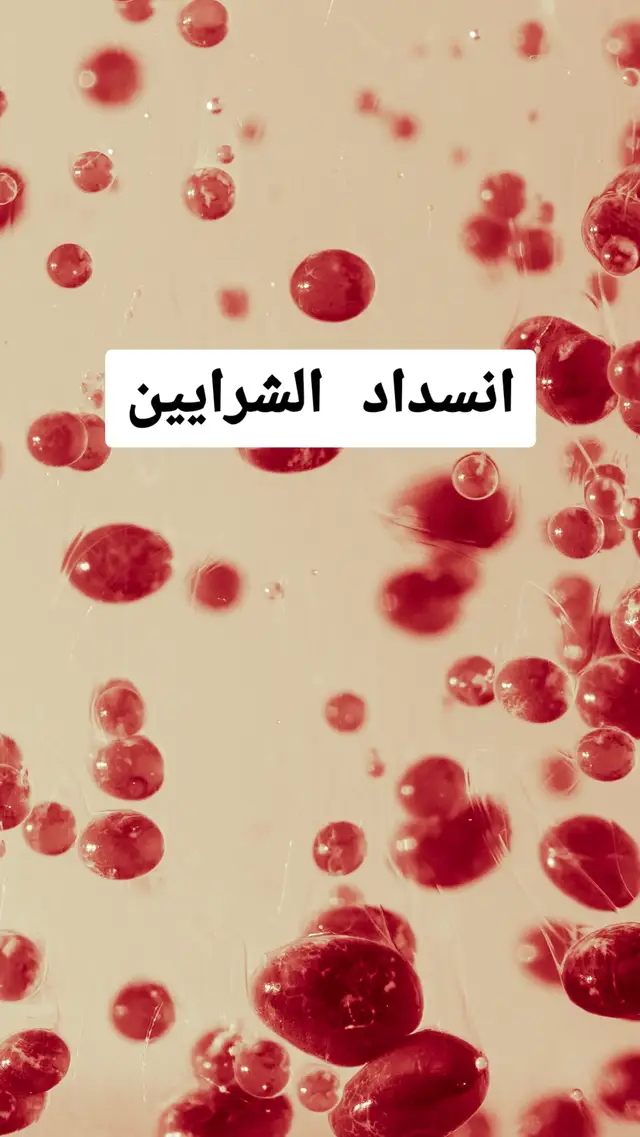 افضل اطعمة تمنع انسداد الشرايين #اكل #اكل_صحي #فواكه #خضر #فوائد #فوائد_صحية #لايك__explore___ #لايك #fruit #fruits #healthy #healthyfood #doctorsoftiktok 