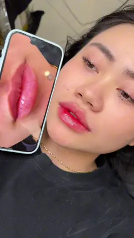 1 từ thôi vuýp - đổi gu thôi nào #ThưThưBeauty #tiêmfillerphanthiết #TiêmMôiĐẹp #tiêmmôi 