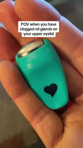 CHALAZION, it was nice knowing you. 