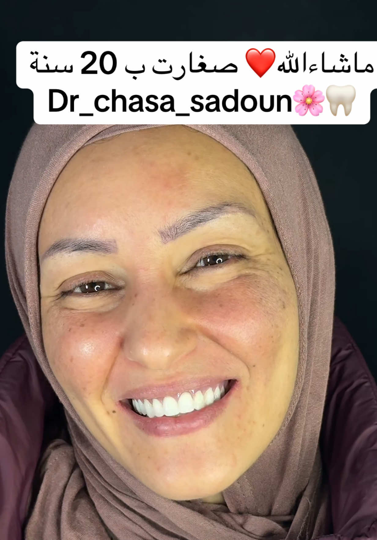 #algerie🇩🇿 #viralvideo🔥 #شعب_الصيني_ماله_حل😂😂 #اسنان #طبيب_اسنان 