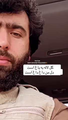 دل من داغ داغ است💔✋🏽