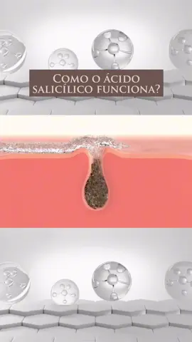 Você usa esses ativos, mas não sabe como agem na pele? ⚜️ O ácido salicílico é o queridinho das peles oleosas. Por ser lipossolúvel, ele entra nos poros, dissolve o acúmulo de óleo, reduz cravos e ajuda a controlar a acne. Além de limpar profundamente, também melhora a textura ao promover uma esfoliação leve e contínua. Exemplos de produtos contendo ácido salicílico: Limpador Antiacne Sallve, Solução de Ácido Salicílico Simple Organic, Effaclar Gel Concentrado La Roche-Posay, Esfoliante Neutrogena Acne Proofing, La Roche-Posay Salicyli C10; Vichy Normaderm Phytosolution Sérum, Eucerin DermoPure Efeito Triplo Sérum. ⚜️O ácido hialurônico segue na direção oposta: ele não esfolia, não trata acne, ele hidrata em profundidade. É um ativo capaz de atrair e reter água, mantendo a pele preenchida, macia e com aparência mais firme. É ideal para melhorar o viço, reduzir linhas superficiais e equilibrar rotinas mais intensas com ácidos que renovam a pele. Exemplos: La Roche-Posay Hyalu B5, Neutrogena Hydro Boost Water Gel, L’Oréal Revitalift Hialurônico, CeraVe Sérum de Ácido Hialurônico e Nivea Facial Hyaluron Cellular Filler. ⚜️ O retinol entra como o regenerador potente. Ele acelera a renovação celular, estimula colágeno e melhora a firmeza, as rugas finas e a textura irregular. Com o uso contínuo, a pele se torna mais uniforme, luminosa e resistente. É um ativo mais concentrado, que precisa de adaptação e do acompanhamento certo, mas entrega resultados visíveis. Exemplos: Esthederm Intensive Retinol Oil Serum, Dermage Retinol + Hialuronic, Principia Rn-0.3 Retinol, Vichy Liftactiv Retinol Specialist e L’Oréal Revitalift Retinol Noturno  ⚜️ Já a vitamina C trabalha na luminosidade e na proteção. É um antioxidante poderoso que combate radicais livres, ilumina, ajuda a uniformizar o tom e potencializa a defesa contra danos externos, inclusive fotoenvelhecimento. É um dos melhores ativos para quem busca manter a pele radiante e com aspecto saudável ao longo do dia. Eemplos: Active CG Avène, Dermage Sérum Improve C 20, La Roche-Posay Pure Vitamin C10, Vichy Liftactiv Sérum Vitamina C, Avène A-Oxitive Sérum Vitamina C, Nivea Q10 + Vitamina C, e Eucerin Anti-Pigment Sérum Vitamina ⚜️ Quando usados de forma correta e estratégica, esses quatro ácidos se complementam e potencializam os resultados da rotina. Cada um com uma função, mas todos contribuindo para uma pele mais equilibrada, luminosa e com textura mais bonita. Qual desses ativos já faz parte da sua rotina? Créditos: @a.m_esthetician #skincare #vitaminac #retinol #acidosalicilico #acidohialuronico     