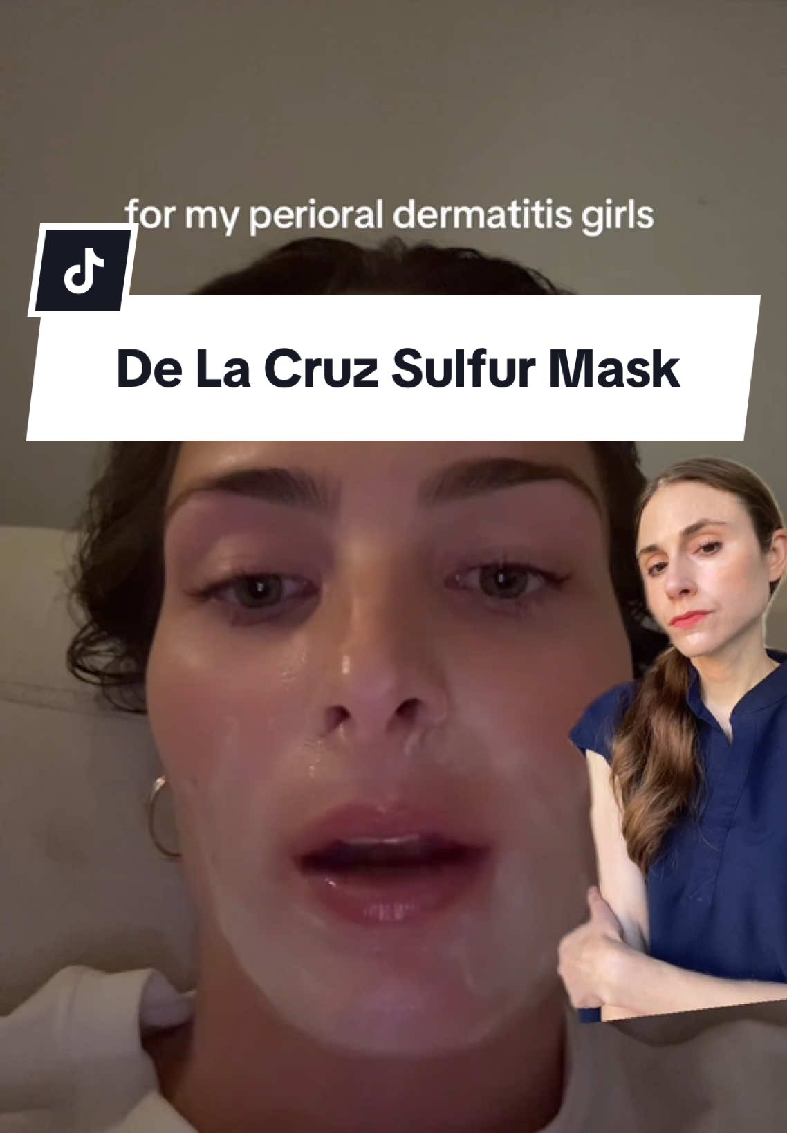 De La Cruz sulfur mask for perioral dermatitis. #perioraledermatitis #skincareadvice #dermatologist #creatorsearchinsights  @Maren Taylor 