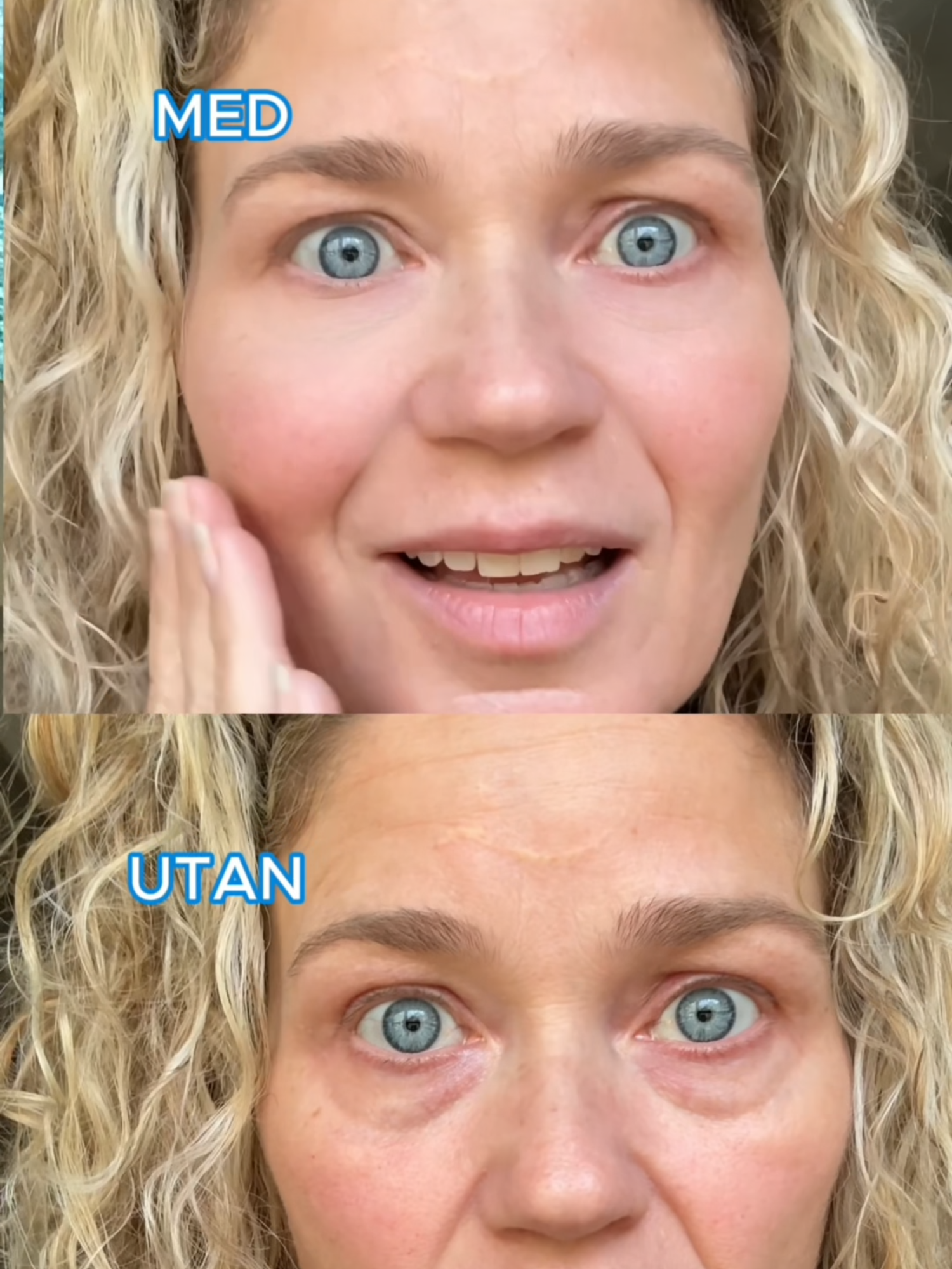 ⚫ BLACK FRIDAY MEGADEAL! 🟡 🖤 50% RABATT + GRATIS Ögonkräm + 🚚 FRI FRAKT 💛 Minska rynkor och påsar under ögonen på bara 60 sekunder! 😍✨ #BrightUp #BlackFriday