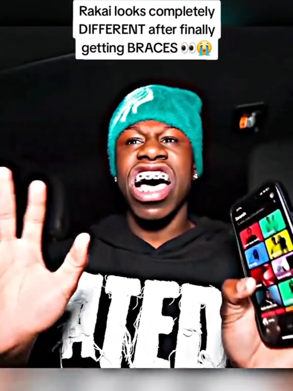 Rakai looks completely DIFFERENT after finally getting BRACES 👀😭 #rakai 