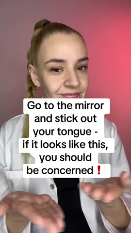 #health #tongue #medicalfacts #healthtips #fyp 