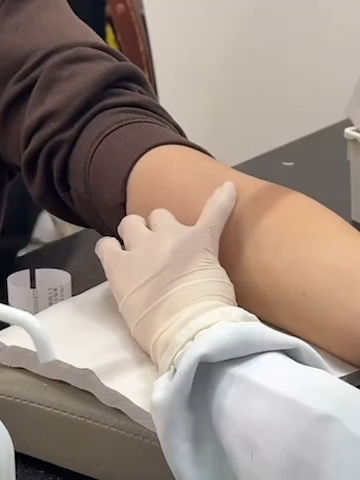 Turning a blood draw into a graceful, pain-free moment. This is the skill and care our nurses bring every day. Pure respect. #MedicalSkills #NurseTikTok #FlyingNeedle 👉 Follow me for more information about hospitals and doctors!