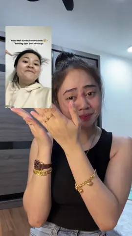 nak baby hair tumbuh macam i guna hair tonic ni confirm menjadi! #hairgrowth #rambutgugur #labonhair #babyhair 
