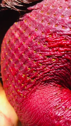 Khoẻ Mới Đẻ Ra Đòn 