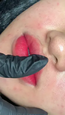 Thoa son thì ai cũng xinh… Nhưng quan trọng là lúc MÔI không có son vẫn ĐẸP Môi hồng tự nhiên để mỗi sáng thức dậy đều thấy mình tươi tắn hơn với khuôn mặt mộc ! >>> Đừng trì hoãn việc tìm giúp bản thân đẹp hơn mỗi ngày, nếu chị em muốn được tư vấn - nhắn cho Trân nhé ! #phunmoidep #khuthammoi #phunmoitunhien #phunmoicantho #cantho 