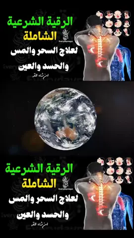 #ruqyah  #jado  #dam 