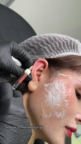 #beauty #pttm #tiktokviral #FillerAnToàn #fypシ 