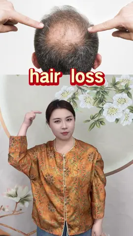 脱发 #hair #hairloss #脱发 #fyp #tcm #中医 #穴位 