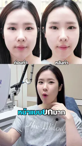 เครื่องที่กระแสแรงที่สุดในตอนนี้จะเป็นอะไรไปได้ถ้าไม่ใช่ OligioX🔥 ของแถมมีแจกให้อีกแค่ 5 วันเท่านั้นน! รีบเลยย❤️‍🔥 #oligiox #oligioรีวิว #เครื่องยกกระชับ #แก้มเหนียง #แก้มหาย #oligiup #oligiup3dliftingfullfacenetgelmask 