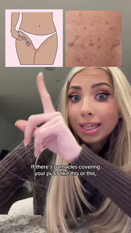 this video is for women only #drmelaxinpeelshot #hyperpigmentation #ingrownhairs 